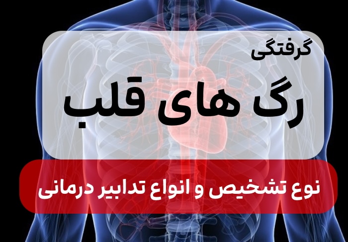 علت،علائم و درمان گرفتگی رگ های قلب,روش تشخیص گرفتگی عروق قلب