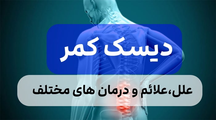 علت،علائم و درمان دیسک کمر,درمان دیسک کمر در طب سنتی ایرانی