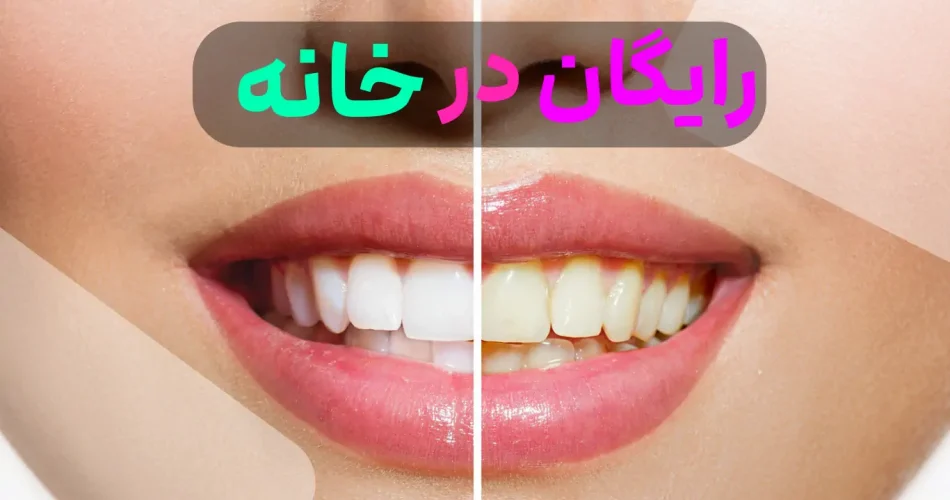سفید کردن دندان در خانه