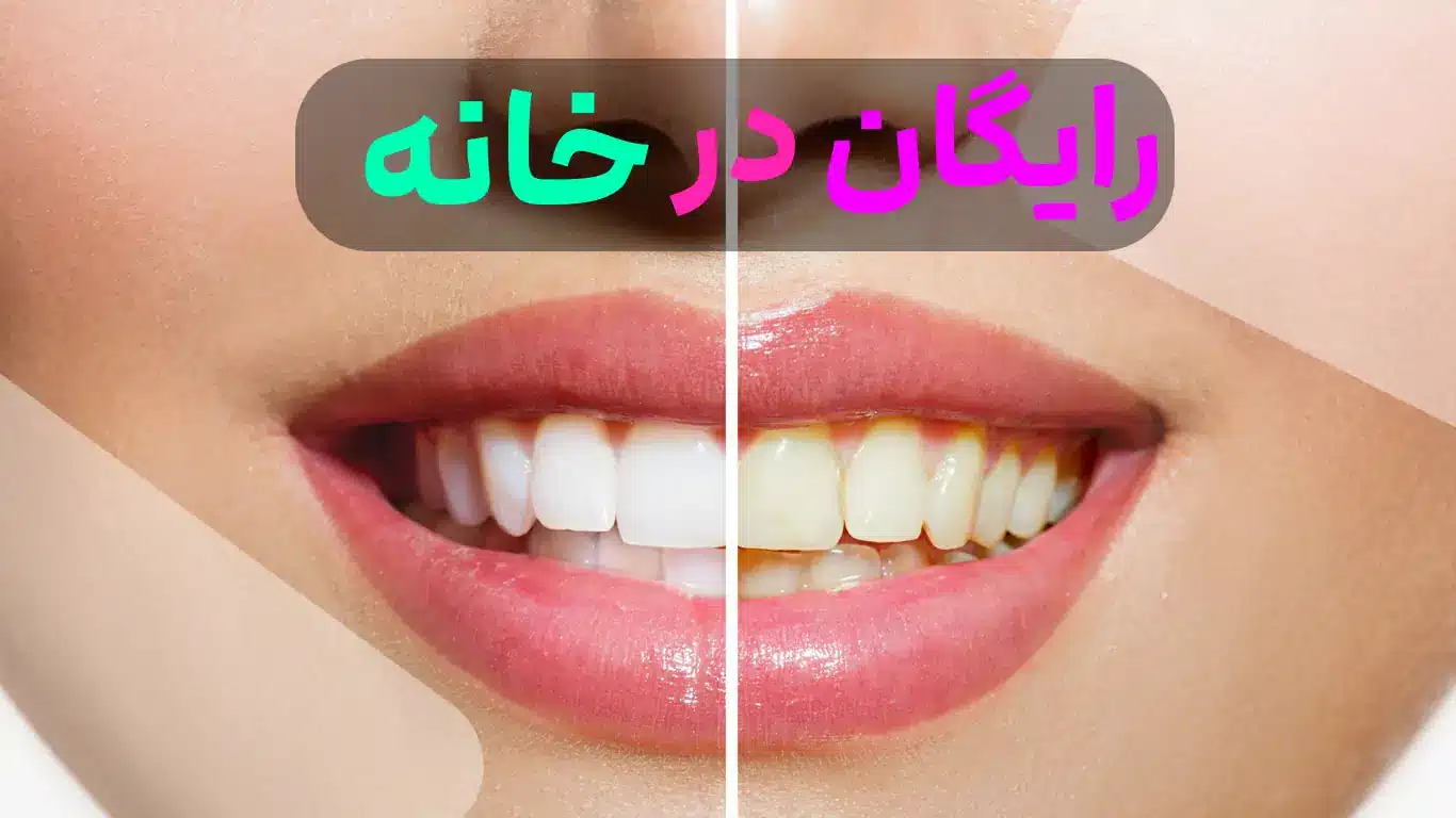 سفید کردن دندان در خانه / رایگان و در عرض دو سه روز