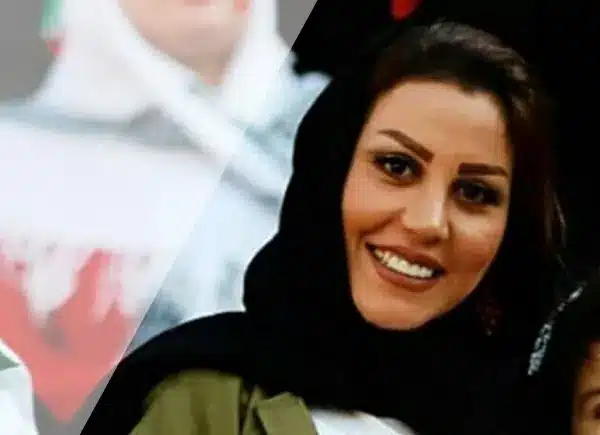 چهره جدید همسر علیرضا بیرانوند / قبل و بعد عمل زیبایی