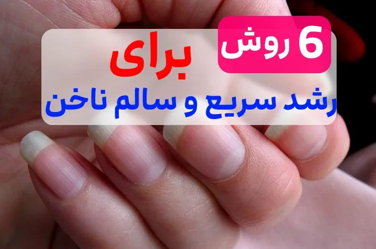 این 6 روش دیگه به کاشت ناخن نیاز نداری 1