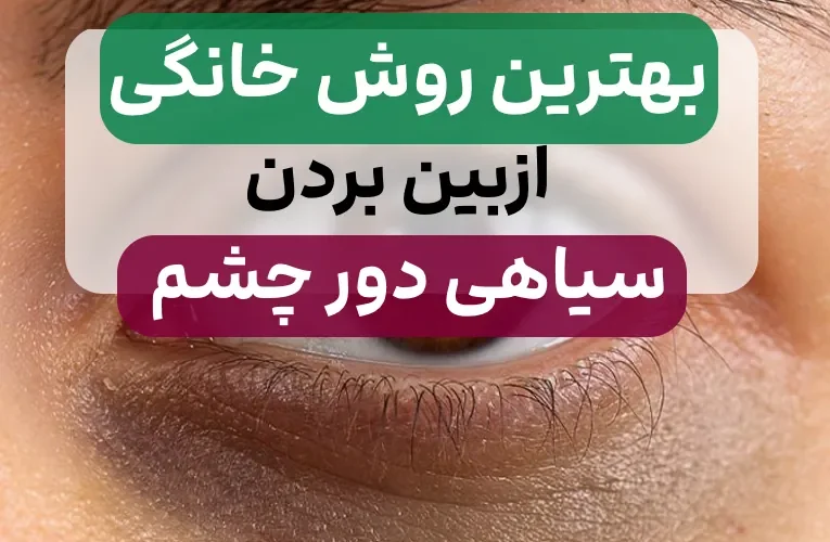 درمان سیاهی دور چشم