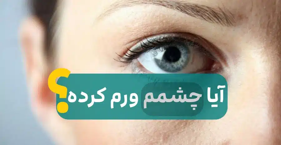 ورم چشم