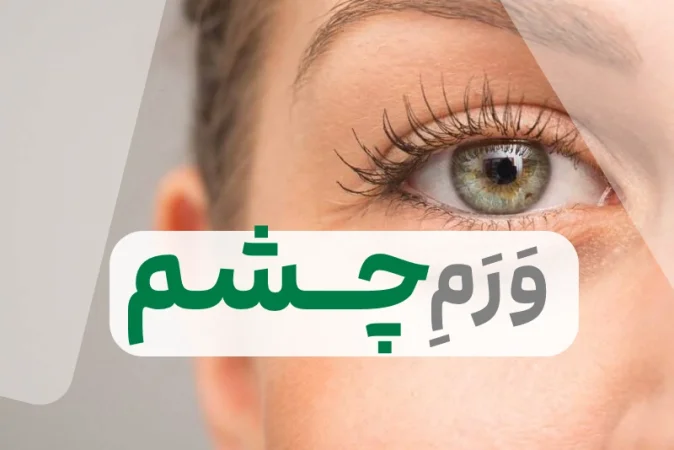 ورم چشم