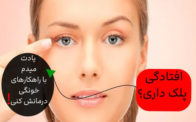 روش های ساده خانگی افتادگی پلکتان را