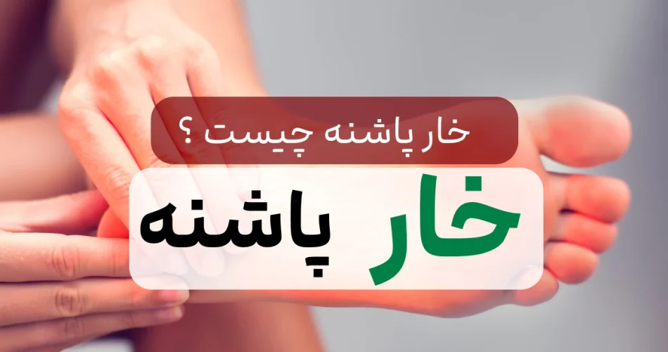پاشنه