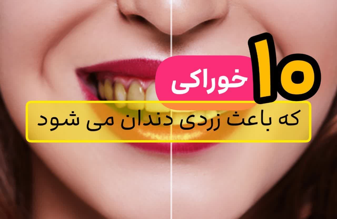 ۱۰ خوراکی که باعث زردی دندان می شود + سفید شدن دندان با 1 نکته ساده