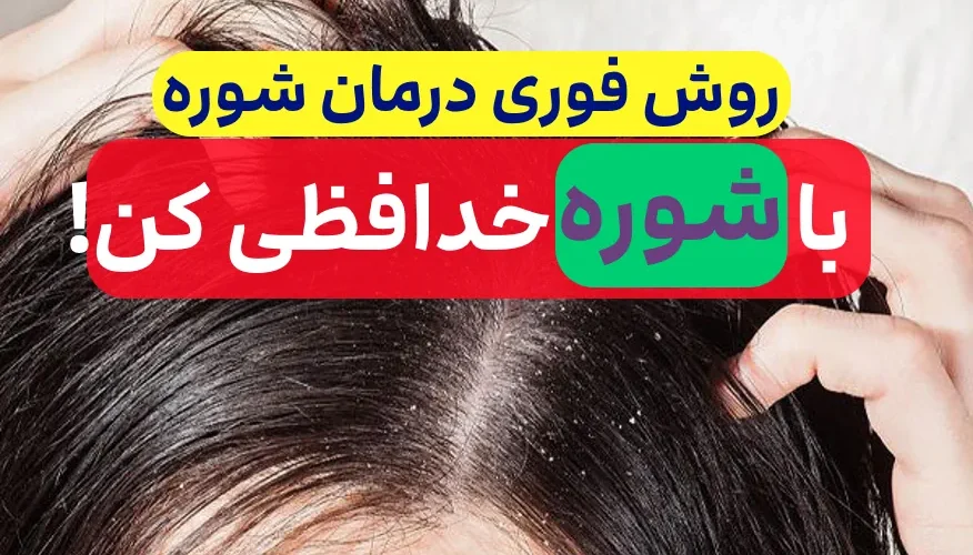 درمان خانگی شوره