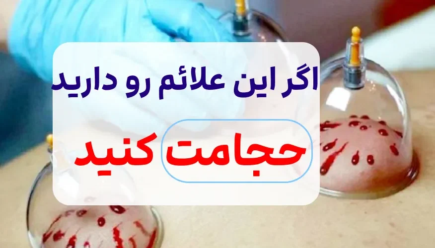زمانی که نیاز است حجامت انجام دهیم