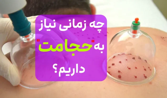علائمی که نشان میدهد نیاز به حجامت دارید مواقعی که باید حجامت کرد