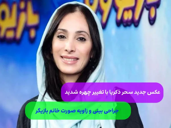 چهره جدید سحر زکریا/ زیبایی چهره او خیرکننده شد + عکس