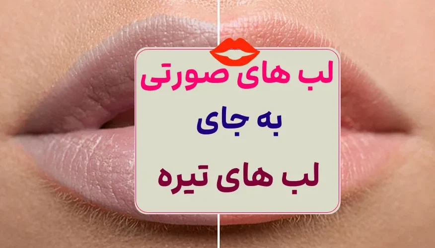 روشن کردن لبها
