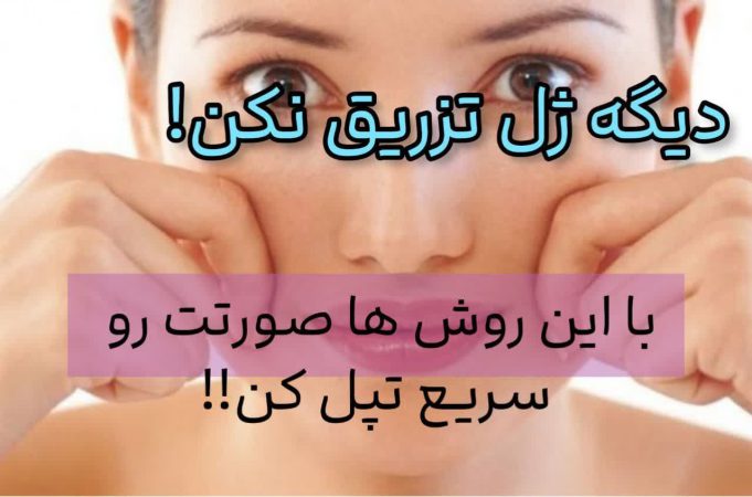 چاقی صورت