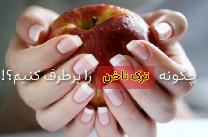 چگونه ترک ناخن را برطرف کنیم؟!