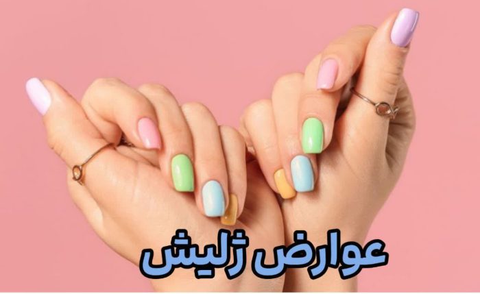 ?۱۰ خطر کاشت ناخن که از آن بی خبریم؟!? چرا باید مراقب باشیم؟؟ 3 عوارض ژلیش