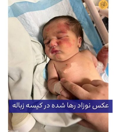 فرشته ی نجاتی به نام سگ؛ سگ مهربان، نوزاد رها شده در زباله ها را پیدا کرد 3 نوزاد رها شده در کیسه زباله