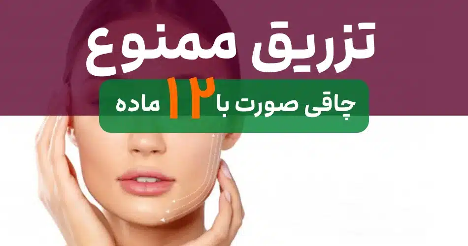 صورت 1
