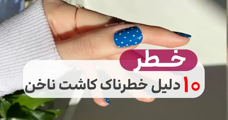 ناخن