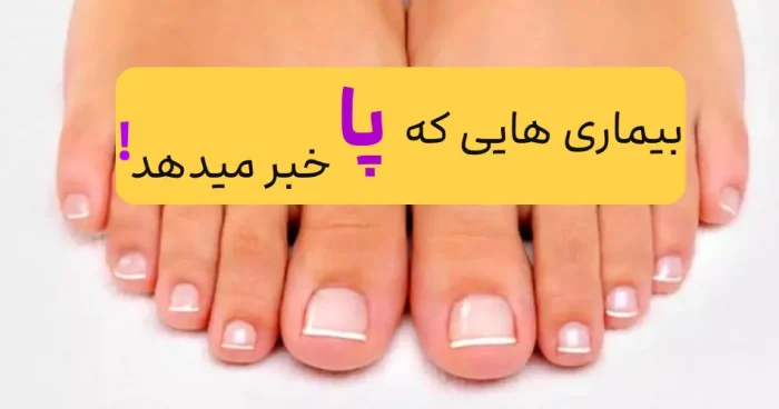 4 بیماری که پاهات بهت خبر میده، علائم در پاها را جدی بگیرید