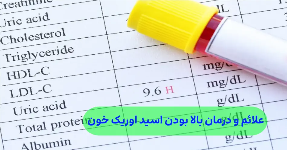 علائم نشان دهنده اوریک بالا در خون ش