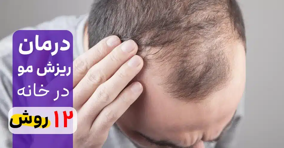 از ریزش مو کلافه شدی؟! درمان ریزش مو در خانه