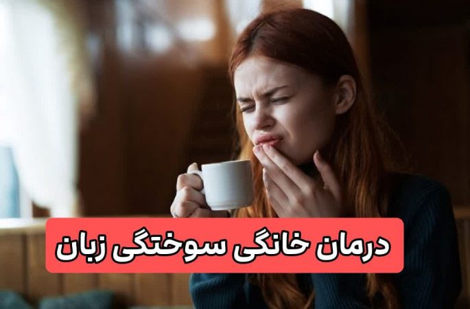 ۱۰ راهکار برای تسکین درد سوختگی زبان هنگام غذا، چای و آب جوش خوردن! 2 درمان خانگی سوختگی زبان