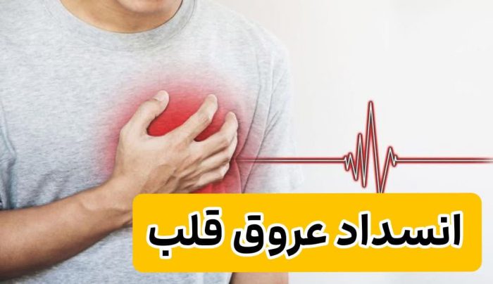 ۰ تا ۱۰۰ سلامتی قلب | در 2 صفحه کوتاه؛ 10 خوراکی برای گرفتگی عروق 3 انسداد عروق قلب