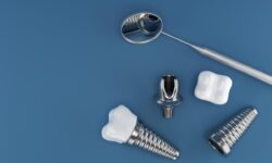 آیا ایمپلنت دندان خراب می‌شود؟